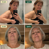 Lyméa Vitalité – Se sentir plus léger jour après jour