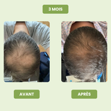 Nexora Vital Men – Épaisseur et vitalité pour vos cheveux