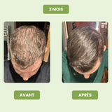 Nexora Vital Men – Épaisseur et vitalité pour vos cheveux
